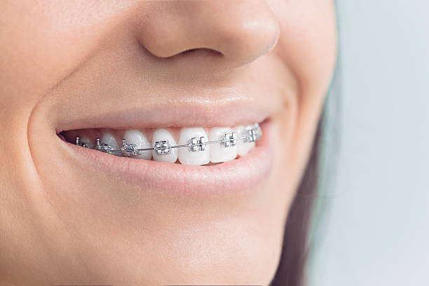 Best Wisdom Tooth Removal  in Lakes Of The Four Seasons, IN